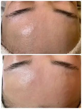 Le cherien所属・Le cherien ルシェリアのエステ・リラクイメージ