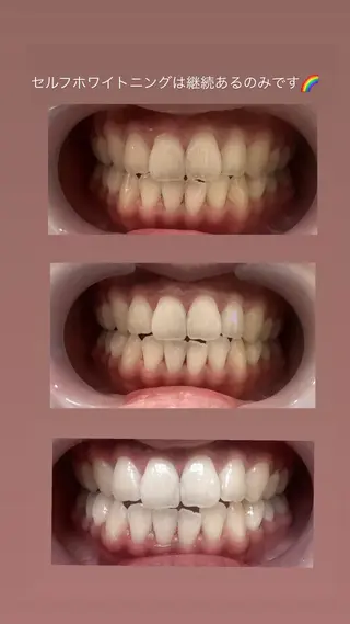 Vistar nail所属・黒崎店 MOMOKAのネイルデザイン