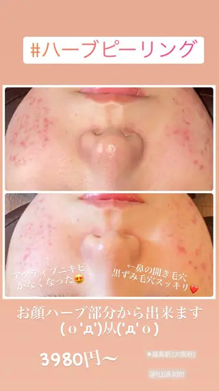 FLEUR大阪・整体 ・ハイフ・痩身・小顔のエステ・リラクイメージ