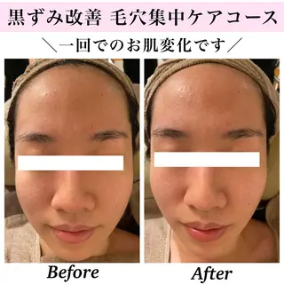 Bellesthe (ベルエステ)のエステ・リラクイメージ