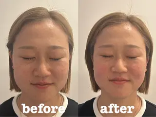美容鍼灸Solana所属・小櫻 唯のエステ・リラクイメージ