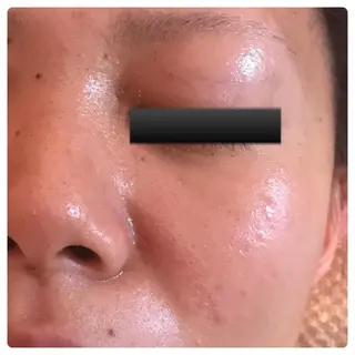 フェアリーローズ所属・fairyrose organicエステのエステ・リラクイメージ