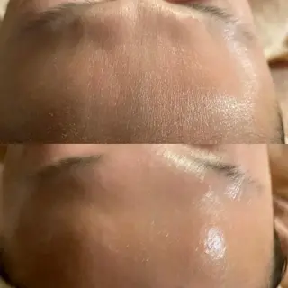 Mandarin Orange所属・毛穴から始める肌メン テマンダリンオレンジのエステ・リラクイメージ