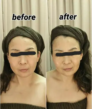 小顔と美肌 まごころエステMatoria所属・小顔 美肌専門 Matoriaのエステ・リラクイメージ