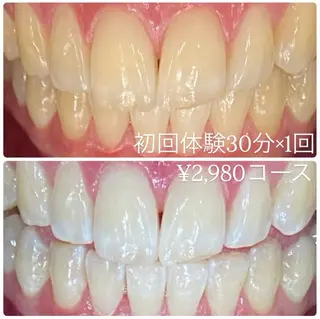 メンズ ホワイトニングルーム　川崎店所属・ホワイトニング ルーム　川崎店のその他イメージ