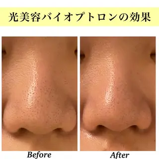 Bellesthe (ベルエステ)のエステ・リラクイメージ