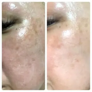 メンズ ネイル マツエク・マツパ エステ.まつげ.小顔 眉毛.プラズマ.脱毛のマツエク・マツパデザイン