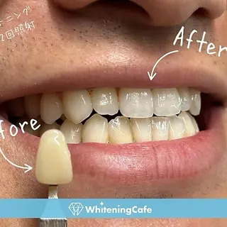 ホワイトニングカフェ神戸元町店所属・ホワイトニングカフェ 神戸元町店のエステ・リラクイメージ