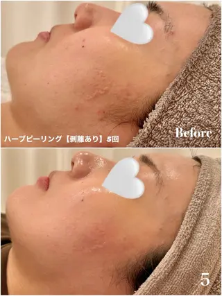 Ayaka🤍 恵比寿/美容鍼/整体のエステ・リラクイメージ