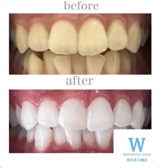 ホワイトニング ショップ本八幡店のエステ・リラクイメージ