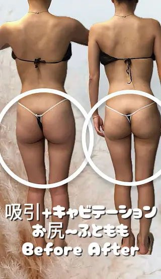 美容整体・塗る漢方・フェイシャルRechica所属・心斎橋痩身 美肌整体サロン💓のエステ・リラクイメージ