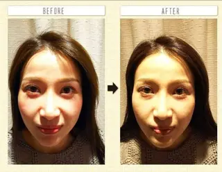 むくみたるみ専門☆ 美容鍼・小顔矯正のエステ・リラクイメージ