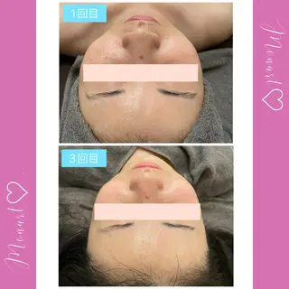 Monart -deux-のエステ・リラクイメージ