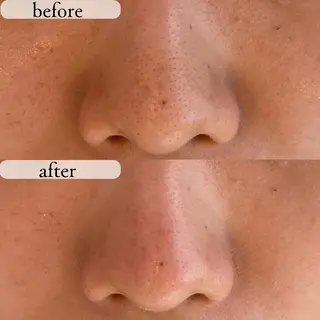 アンテインチル 山本のエステ・リラクイメージ