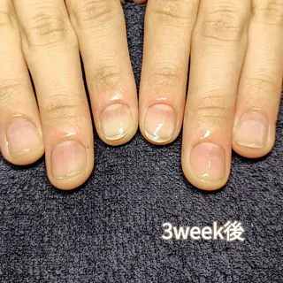 ネイル 深爪矯正/爪育成ケア manie nailのネイルデザイン