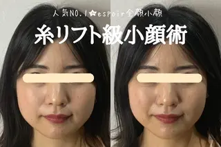 最速小顔・肌質管理 ❣️エスポワールのエステ・リラクイメージ