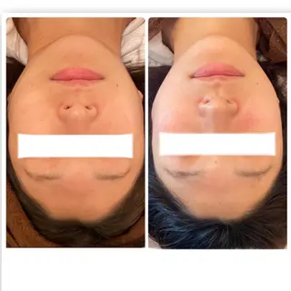 FLEUR大阪・美容 整体・痩身・小顔のエステ・リラクイメージ