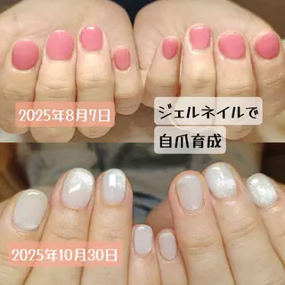 ネイル 深爪矯正/爪育成ケア manie nailのネイルデザイン