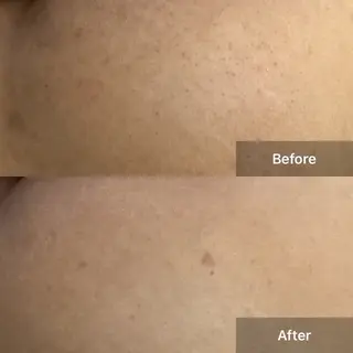 ハーブピーリング 専門店MOKA所属・ハーブピーリング専門 MOKAのエステ・リラクイメージ