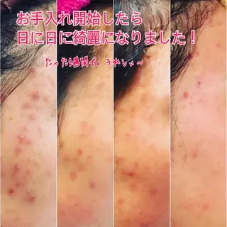 フェイシャルワックス 自然派エステファーノのその他イメージ