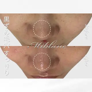 肌質管理 MIBLANC上野店のその他イメージ