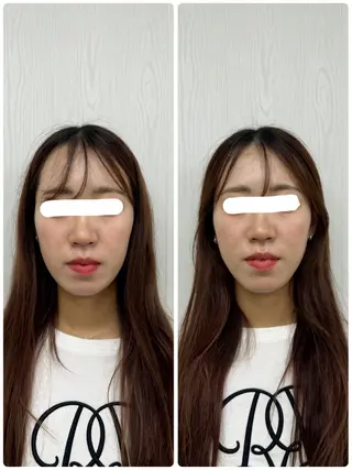 美容鍼×小顔矯正 ×美容整体 浜川泰仁のエステ・リラクイメージ