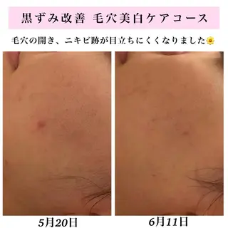 Bellesthe (ベルエステ)のエステ・リラクイメージ