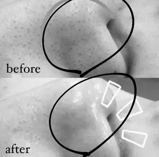 eclair エクレイルのエステ・リラクイメージ