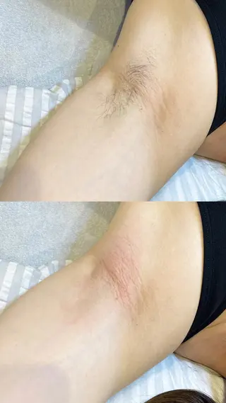 VIO脱毛専門店　kika〜キカ〜所属・【メンズSTART】 VIO専門店kikaのエステ・リラクイメージ