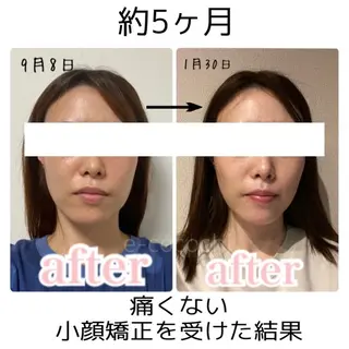 小顔と ヘッドスパのお店のエステ・リラクイメージ