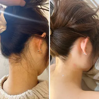 うなじ脱毛/美肌脱毛 LABELのエステ・リラクイメージ