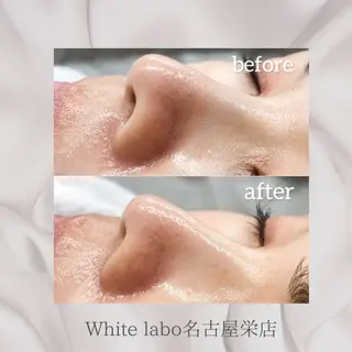 White labo 🇰🇷REIの眉毛・アイブロウイメージ