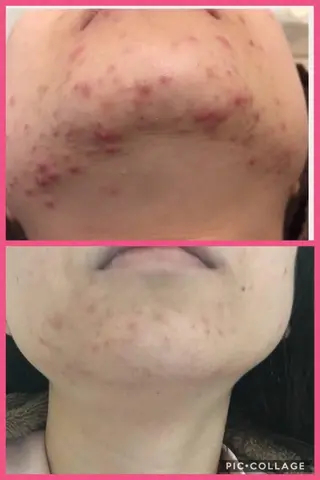 セミロング カラー パーマ ヘアアレンジ メンズ キッズ ネイル マツエク・マツパ 四つ星サロン🎖 腸＆ニキビケアに特化のエステ・リラクイメージ