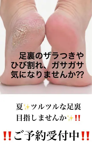 Yabiku Airiのネイルデザイン