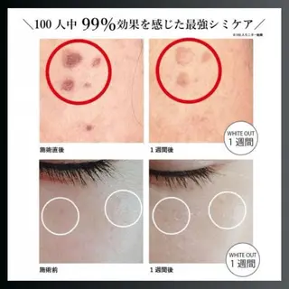 LiZA エステティックサロンのエステ・リラクイメージ