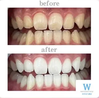 ホワイトニング ショップ本八幡店のエステ・リラクイメージ