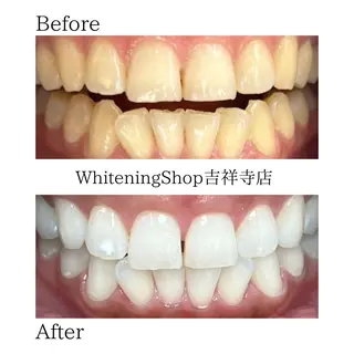 ホワイトニング専門店 御殿山/吉祥寺店のその他イメージ