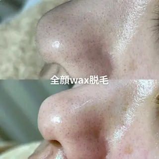 EST BEAUTY所属・顔専門ワックス脱毛/ ハーブピーリングのエステ・リラクイメージ