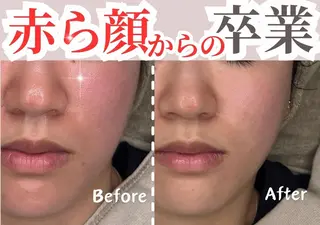 sii センター北 AIのエステ・リラクイメージ