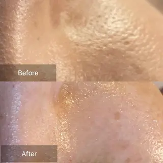 Mandarin Orange所属・毛穴から始める肌メン テマンダリンオレンジのエステ・リラクイメージ