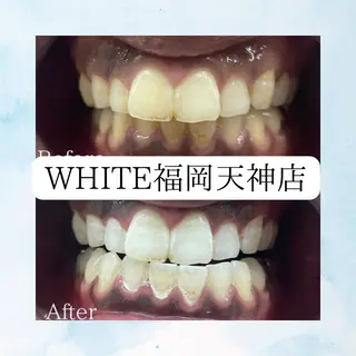 メンズ ホワイトニング専門店 WHITE天神店のエステ・リラクイメージ
