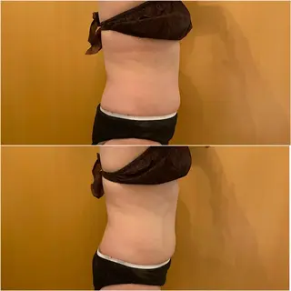 ✨美肌水光✨ アトリエリュバンのエステ・リラクイメージ