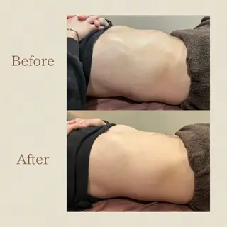 お腹痩せエステ Flat BELLY 恵比寿所属・【腸もみ/脂肪冷却】 お腹エステ/恵比寿のエステ・リラクイメージ
