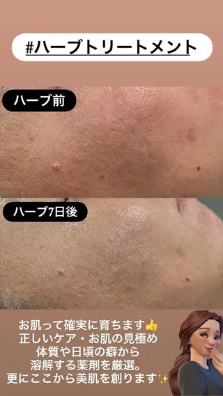 LiZA エステティックサロンのエステ・リラクイメージ