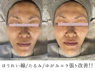 頭蓋骨小顔コルギPerm所属・頭蓋骨小顔コルギ Permのその他イメージ