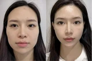 マツエク・マツパ aliaハイフ&水光ジェットサロン所属・aliaハーブ水光店 エステティシャン募集のエステ・リラクイメージ