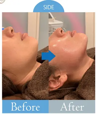 美肌/小顔/眉毛の 専門店 ルミナスの眉毛・アイブロウイメージ