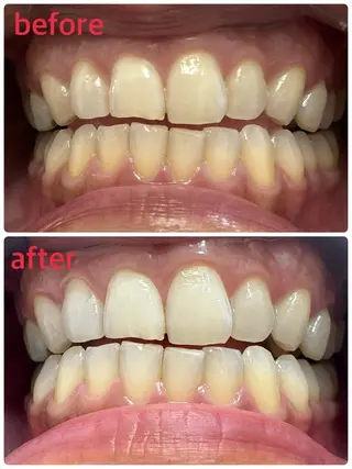 ホワイトニングサロンaile所属・セルフホワイトニング 金城しおりのその他イメージ