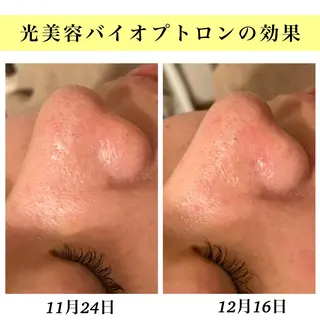 Bellesthe (ベルエステ)のエステ・リラクイメージ