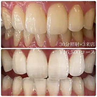 PLATINUM Beauty 横浜店所属・ホワイトニングルーム 横浜店のその他イメージ